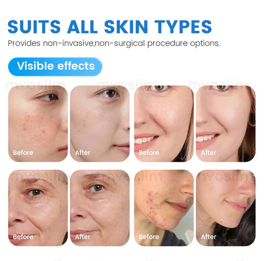 TAIXL 7 In 1 Hydra Oxygen Dermabrasion Facial Machine