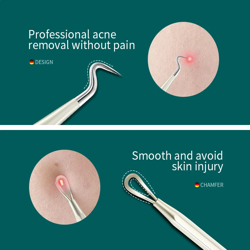 MR.GREEN Acne Remover Needles Blackhead Extractor Set Stainless Steel